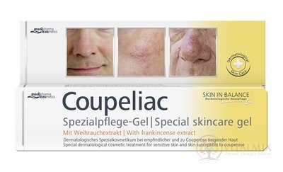 SIB COUPELIAC Špeciálny gél proti začervenaniu, sensitive 1x20 ml