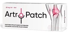 Artro-Patch Implantát na báze HA 80 mg/4 ml v predplnenej injekčnej striekačke, na náhradu synoviálnej tekutiny (20 mg/ml) 1x4 ml